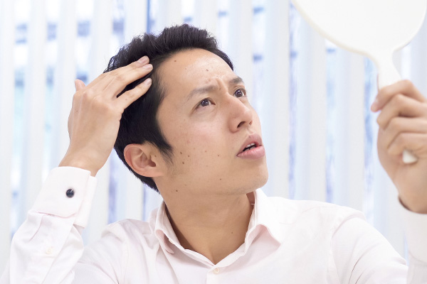薄毛を悩む男性のイメージ画像