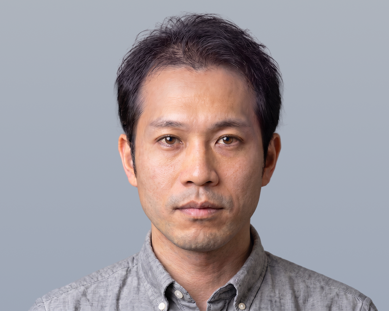 顔全体 After（施術後イメージ）